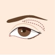 Double-Blepharoplasty-Eyelid-Surgery_illustration